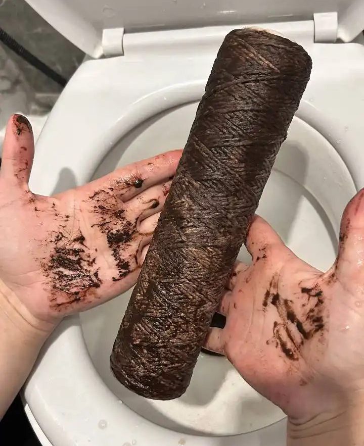 Состояние фильтра в Смолевичах. Фото: Instagram.